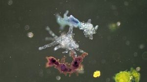 Tampilan mikroskopis amoeba proteus atau mikroorganisme air di bawah perbesaran