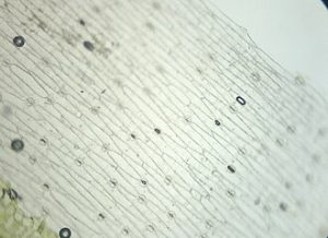 Tampilan mikroskopis stomata pada epidermis daun di bawah perbesaran